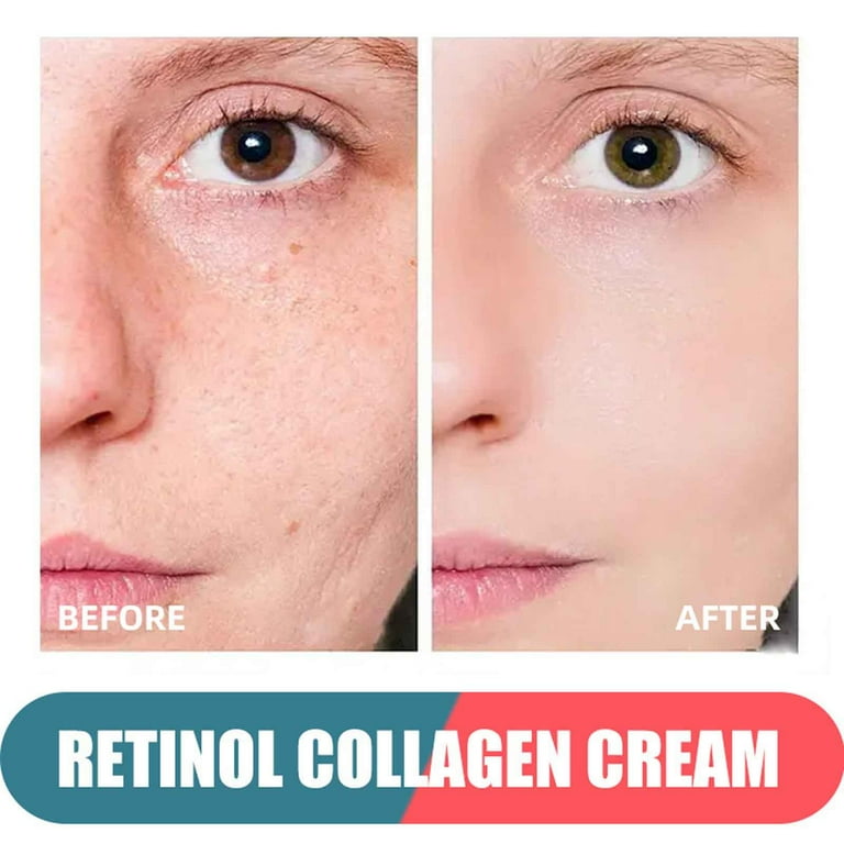Retinol Cream for Face - Facial Moisturizer with Collagen 50ml