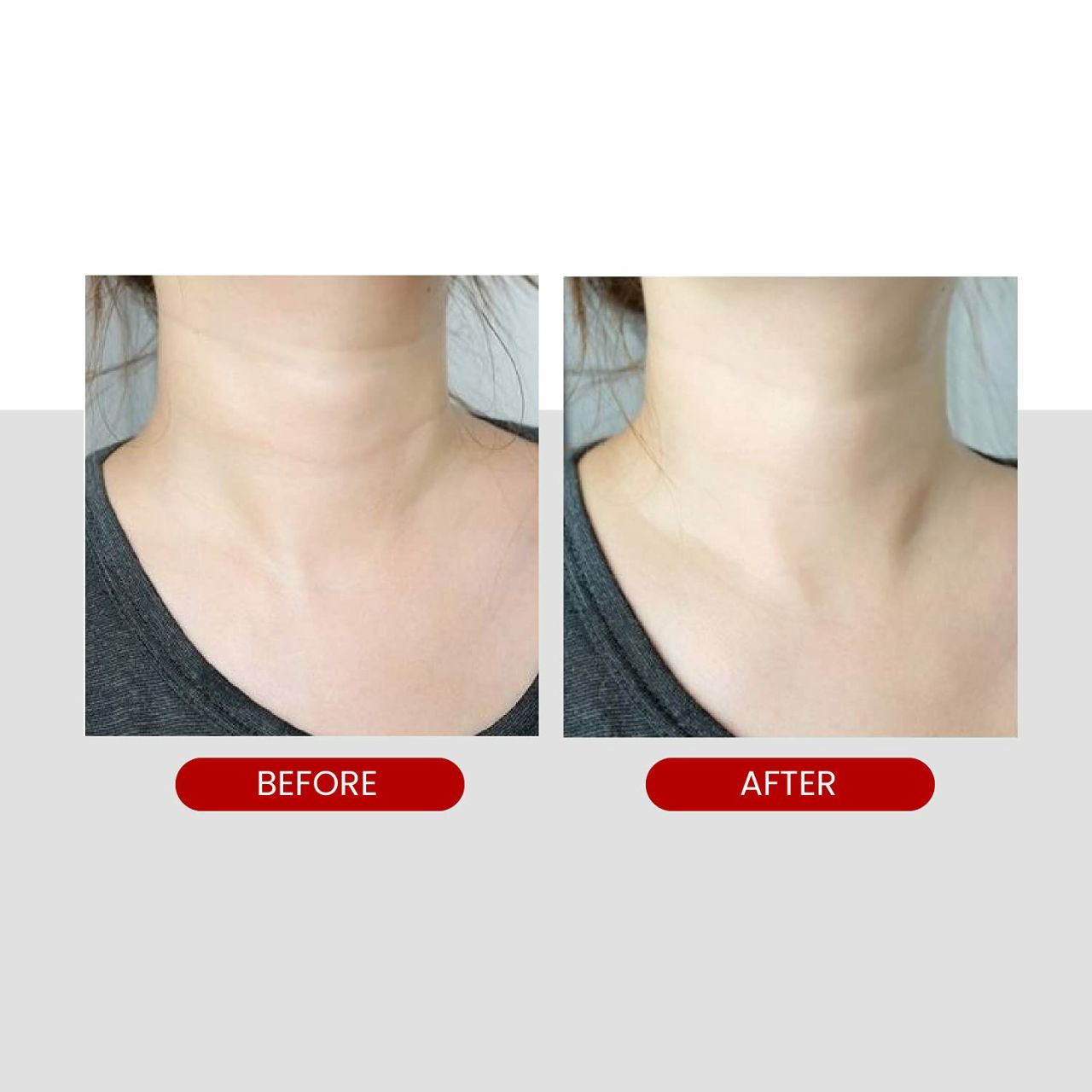 MEDIPEEL Collagen Naite Thread Neck Cream 100ml
