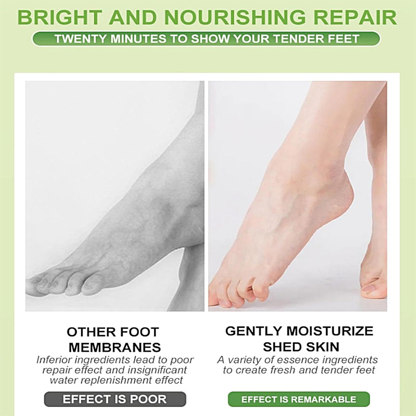 Foot Peel Mask for Soft Baby Feet, Hard Skin Remover Foot Mask, Moisturizing (Avocado)